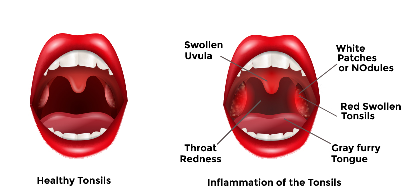 Best Thyroid Surgery in Hyderabad - MAA ENT Hospitals